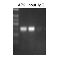 ChIP analysis of Cervical cancer cell lines lysate incubated for 12 hours at 4 C. Cross-linking (X-ChIP) using formaldehyde for 10 minutes. Detection step: Semiquantitative PCR. Positive control: Tumor cell lines Hela. Negative control: Human primary keratinocytes.
