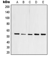 Western blot analysis of TFDP1 expression in HEK293T (A); A431 (B); Raji (C); mouse heart (D); PC12 (E) whole cell lysates.