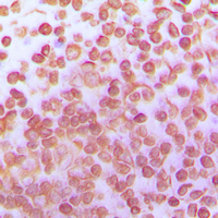 Immunohistochemical analysis of TFDP1 staining in human tonsil formalin fixed paraffin embedded tissue section. The section was pre-treated using heat mediated antigen retrieval with sodium citrate buffer (pH 6.0). The section was then incubated with the antibody at room temperature and detected using an HRP conjugated compact polymer system. DAB was used as the chromogen. The section was then counterstained with haematoxylin and mounted with DPX.