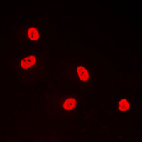 Immunofluorescent analysis of TFDP1 staining in A431 cells. Formalin-fixed cells were permeabilized with 0.1% Triton X-100 in TBS for 5-10 minutes and blocked with 3% BSA-PBS for 30 minutes at room temperature. Cells were probed with the primary antibody in 3% BSA-PBS and incubated overnight at 4 C in a humidified chamber. Cells were washed with PBST and incubated with a DyLight 594-conjugated secondary antibody (red) in PBS at room temperature in the dark. DAPI was used to stain the cell nuclei (blue).