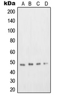 Western blot analysis of DP2 expression in Jurkat (A); A431 (B); Hep G2 (C); COS7 (D) whole cell lysates.