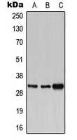 Western blot analysis of PBR expression in HEK293T (A); SP2/0 (B); PC12 (C) whole cell lysates.
