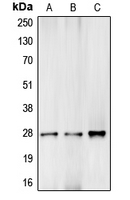 Western blot analysis of Complement C1R LC expression in HEK293T (A); mouse liver (B); rat kidney (C) whole cell lysates.