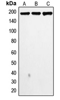 Western blot analysis of Topoisomerase 2 alpha expression in MDAMB468 (A); MDAMB231 (B); HeLa (C) whole cell lysates.
