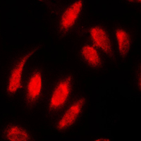 Immunofluorescent analysis of Topoisomerase 2 alpha staining in MDAMB231 cells. Formalin-fixed cells were permeabilized with 0.1% Triton X-100 in TBS for 5-10 minutes and blocked with 3% BSA-PBS for 30 minutes at room temperature. Cells were probed with the primary antibody in 3% BSA-PBS and incubated overnight at 4 C in a humidified chamber. Cells were washed with PBST and incubated with a DyLight 594-conjugated secondary antibody (red) in PBS at room temperature in the dark. DAPI was used to stain the cell nuclei (blue).