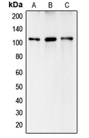 Western blot analysis of Complement C6 expression in HeLa (A); HepG2 (B); A549 (C) whole cell lysates.