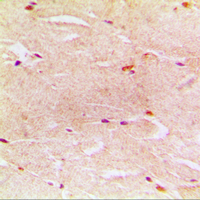 Immunohistochemical analysis of Alpha-actin-3 staining in human muscle formalin fixed paraffin embedded tissue section. The section was pre-treated using heat mediated antigen retrieval with sodium citrate buffer (pH 6.0). The section was then incubated with the antibody at room temperature and detected using an HRP conjugated compact polymer system. DAB was used as the chromogen. The section was then counterstained with haematoxylin and mounted with DPX.