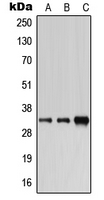 Western blot analysis of Carbonic Anhydrase 6 expression in HEK293T (A); SP2/0 (B); H9C2 (C) whole cell lysates.