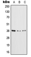 Western blot analysis of XRCC4 expression in HeLa (A); MCF7 (B); NIH3T3 (C) whole cell lysates.