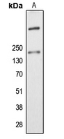 Western blot analysis of ALMS1 expression in K562 (A) whole cell lysates.
