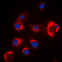 Immunofluorescent analysis of ZIP7 staining in MCF7 cells. Formalin-fixed cells were permeabilized with 0.1% Triton X-100 in TBS for 5-10 minutes and blocked with 3% BSA-PBS for 30 minutes at room temperature. Cells were probed with the primary antibody in 3% BSA-PBS and incubated overnight at 4 C in a humidified chamber. Cells were washed with PBST and incubated with a DyLight 594-conjugated secondary antibody (red) in PBS at room temperature in the dark. DAPI was used to stain the cell nuclei (blue).