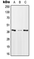 Western blot analysis of mTERF expression in HeLa (A); Raw264.7 (B); PC12 (C) whole cell lysates.