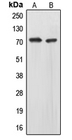 Western blot analysis of EOMES expression in HepG2 (A); IMR32 (B) whole cell lysates.