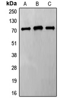 Western blot analysis of Frizzled 8 expression in HeLa (A); Jurkat (B); MCF7 (C) whole cell lysates.