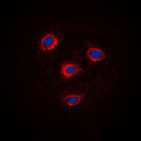 Immunofluorescent analysis of Frizzled 8 staining in Jurkat cells. Formalin-fixed cells were permeabilized with 0.1% Triton X-100 in TBS for 5-10 minutes and blocked with 3% BSA-PBS for 30 minutes at room temperature. Cells were probed with the primary antibody in 3% BSA-PBS and incubated overnight at 4 C in a humidified chamber. Cells were washed with PBST and incubated with a DyLight 594-conjugated secondary antibody (red) in PBS at room temperature in the dark. DAPI was used to stain the cell nuclei (blue).
