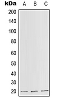 Western blot analysis of SLC25A11 expression in HepG2 (A); Raw264.7 (B); H9C2 (C) whole cell lysates.