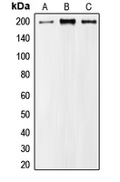 Western blot analysis of MRCK alpha expression in A549 (A); HeLa (B); NIH3T3 (C) whole cell lysates.