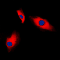 Immunofluorescent analysis of Alpha-actin-3 staining in HeLa cells. Formalin-fixed cells were permeabilized with 0.1% Triton X-100 in TBS for 5-10 minutes and blocked with 3% BSA-PBS for 30 minutes at room temperature. Cells were probed with the primary antibody in 3% BSA-PBS and incubated overnight at 4 C in a humidified chamber. Cells were washed with PBST and incubated with a DyLight 594-conjugated secondary antibody (red) in PBS at room temperature in the dark. DAPI was used to stain the cell nuclei (blue).