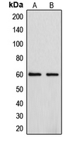 Western blot analysis of Cytochrome P450 4F2 expression in A549 (A); HepG2 (B) whole cell lysates.