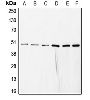 Western blot analysis of COPS3 expression in HeLa (A); SP2/0 (B); mouse liver (C); rat liver (D); NIH3T3 (E); HEK293T (F) whole cell lysates.