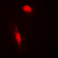 Immunofluorescent analysis of COPS3 staining in HeLa cells. Formalin-fixed cells were permeabilized with 0.1% Triton X-100 in TBS for 5-10 minutes and blocked with 3% BSA-PBS for 30 minutes at room temperature. Cells were probed with the primary antibody in 3% BSA-PBS and incubated overnight at 4 C in a humidified chamber. Cells were washed with PBST and incubated with a DyLight 594-conjugated secondary antibody (red) in PBS at room temperature in the dark. DAPI was used to stain the cell nuclei (blue).