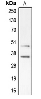 Western blot analysis of CDK10 expression in Jurkat (A) whole cell lysates.