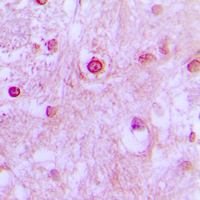 Immunohistochemical analysis of CDK10 staining in human brain formalin fixed paraffin embedded tissue section. The section was pre-treated using heat mediated antigen retrieval with sodium citrate buffer (pH 6.0). The section was then incubated with the antibody at room temperature and detected using an HRP conjugated compact polymer system. DAB was used as the chromogen. The section was then counterstained with haematoxylin and mounted with DPX.
