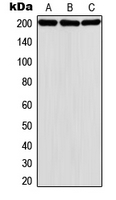 Western blot analysis of MADD expression in HeLa (A); A431 (B); K562 (C) whole cell lysates.