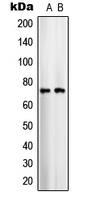 Western blot analysis of ARALAR1 expression in COLO205 (A); U251MG (B) whole cell lysates.