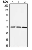 Western blot analysis of EIF3F expression in HeLa (A); HepG2 (B); NIH3T3 (C) whole cell lysates.