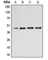 Western blot analysis of B4GALT3 expression in Jurkat (A); HL60 (B); HeLa (C); COLO205 (D) whole cell lysates.