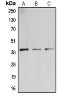 Western blot analysis of B3GALT4 expression in PC3 (A); Jurkat (B); U87MG (C) whole cell lysates.