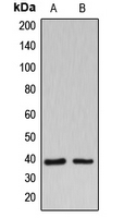 Western blot analysis of B3GALT1 expression in Jurkat (A); HuvEc (B) whole cell lysates.