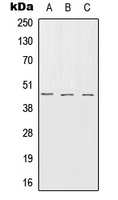 Western blot analysis of Serpin B7 expression in HEK293T (A); SP2/0 (B); rat brain (C) whole cell lysates.