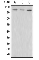 Western blot analysis of MRP3 expression in HepG2 (A); MCF7 (B); MDAMB435 (C) whole cell lysates.