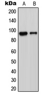 Western blot analysis of ADAM23 expression in Jurkat (A); MCF7 (B); Raw264.7 (C) whole cell lysates.