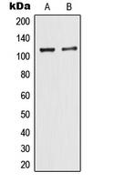 Western blot analysis of TIF1 alpha expression in MCF7 (A); HeLa (B) whole cell lysates.