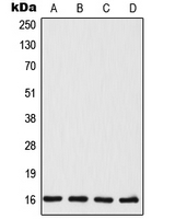 Western blot analysis of TSC22 expression in MCF7 (A); HeLa (B); mouse liver (C); rat liver (D) whole cell lysates.