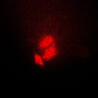 Immunofluorescent analysis of TSC22 staining in HeLa cells. Formalin-fixed cells were permeabilized with 0.1% Triton X-100 in TBS for 5-10 minutes and blocked with 3% BSA-PBS for 30 minutes at room temperature. Cells were probed with the primary antibody in 3% BSA-PBS and incubated overnight at 4 C in a humidified chamber. Cells were washed with PBST and incubated with a DyLight 594-conjugated secondary antibody (red) in PBS at room temperature in the dark. DAPI was used to stain the cell nuclei (blue).