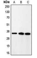 Western blot analysis of p35 expression in rat brain (A); HeLa (B); A431 (C) whole cell lysates.
