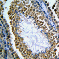 Immunohistochemical analysis of GANP staining in human tonsil formalin fixed paraffin embedded tissue section. The section was pre-treated using heat mediated antigen retrieval with sodium citrate buffer (pH 6.0). The section was then incubated with the antibody at room temperature and detected using an HRP conjugated compact polymer system. DAB was used as the chromogen. The section was then counterstained with haematoxylin and mounted with DPX.