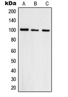 Western blot analysis of Topoisomerase 3 beta1 expression in HepG2 (A); A431 (B); HeLa (C) whole cell lysates.