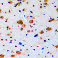Immunohistochemical analysis of Topoisomerase 3 beta1 staining in human brain formalin fixed paraffin embedded tissue section. The section was pre-treated using heat mediated antigen retrieval with sodium citrate buffer (pH 6.0). The section was then incubated with the antibody at room temperature and detected using an HRP conjugated compact polymer system. DAB was used as the chromogen. The section was then counterstained with haematoxylin and mounted with DPX.