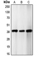 Western blot analysis of p39 expression in SHSY5Y (A); HeLa (B); U87MG (C) whole cell lysates.