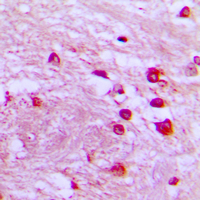 Immunohistochemical analysis of p39 staining in human brain formalin fixed paraffin embedded tissue section. The section was pre-treated using heat mediated antigen retrieval with sodium citrate buffer (pH 6.0). The section was then incubated with the antibody at room temperature and detected using an HRP conjugated compact polymer system. DAB was used as the chromogen. The section was then counterstained with haematoxylin and mounted with DPX.