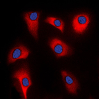 Immunofluorescent analysis of p39 staining in HeLa cells. Formalin-fixed cells were permeabilized with 0.1% Triton X-100 in TBS for 5-10 minutes and blocked with 3% BSA-PBS for 30 minutes at room temperature. Cells were probed with the primary antibody in 3% BSA-PBS and incubated overnight at 4 C in a humidified chamber. Cells were washed with PBST and incubated with a DyLight 594-conjugated secondary antibody (red) in PBS at room temperature in the dark. DAPI was used to stain the cell nuclei (blue).