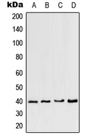 Western blot analysis of CCRL2 expression in HeLa (A); mouse heart (B); mouse brain (C); rat brain (D) whole cell lysates.