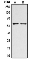 Western blot analysis of DOK2 (pY299) expression in A549 Insulin-treated (A); HepG2 (B) whole cell lysates.