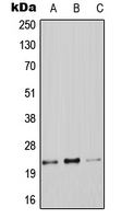 Western blot analysis of Claudin 9 expression in A549 (A); Raw264.7 (B); PC12 (C) whole cell lysates.
