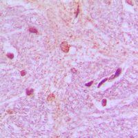Immunohistochemical analysis of TBX15/18 staining in human brain formalin fixed paraffin embedded tissue section. The section was pre-treated using heat mediated antigen retrieval with sodium citrate buffer (pH 6.0). The section was then incubated with the antibody at room temperature and detected using an HRP conjugated compact polymer system. DAB was used as the chromogen. The section was then counterstained with haematoxylin and mounted with DPX.